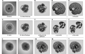 یه کشف جدید در مورد پارکینسون میگه که ممکنه همین الان یه درمان تأیید شده توسط FDA داشته باشیم